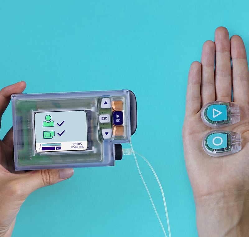 Kunstmatige Alvleesklier